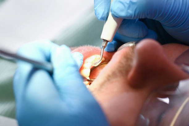 Best Emergency TMJ Treatment in East Pepperell, MA