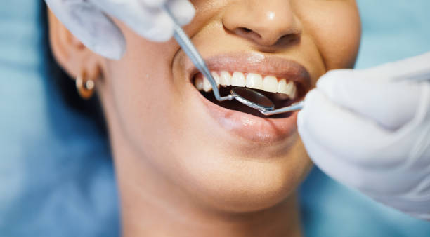 Best Emergency Dental Care for Broken or Chipped Teeth in East Pepperell, MA