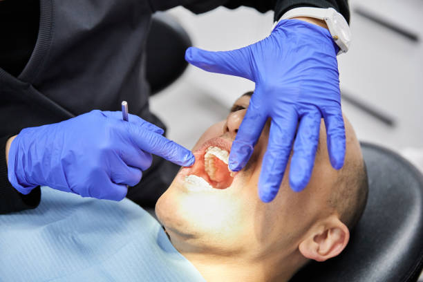 Best Emergency Treatment for Dental Infections or Abscesses in East Pepperell, MA